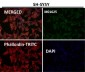 Anti-SNAP25 Rabbit Monoclonal Antibody